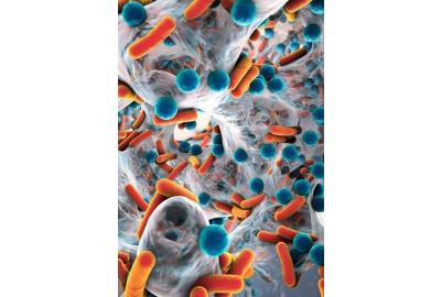 Minimizing risk of surgical instruments contamination